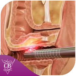 Rejuvenescimento Íntimo